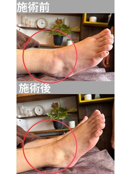 キモチ上がるカラダ改善2人3客/