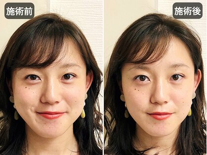 アオヤマ サロン ワイゼット(AOYAMA SALON YZ)の写真