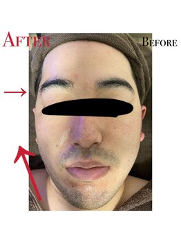 アリッチ 岡崎店(a.Rich)/リフトアップフェイシャル最高☆