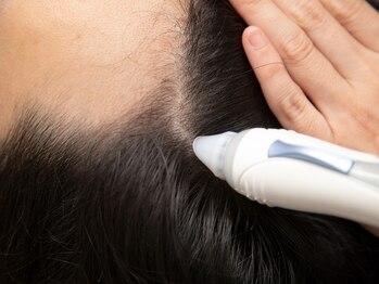 メンズカラー 成田店(Calla)/育毛促進スカルプケア