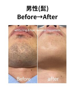 ハピネス 心斎橋アメリカ村本店(Happiness)/