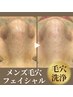 メンズ【毛穴洗浄】毛穴汚れ+黒ずみ/いちご鼻解消！自慢の素肌に◎初回¥6,500