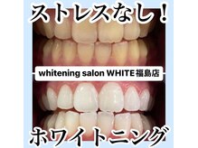 ホワイトニングサロン ホワイト(WHITE)/セルフホワイトニング/大阪/福島