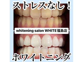 ホワイトニングサロン ホワイト(WHITE)/セルフホワイトニング/大阪/福島