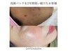 リピーター多数【洗顔パック＋アイパワーエステ】通常￥15730→￥11330