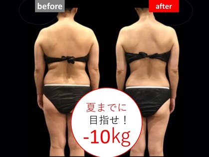 オージャス(OJAS)の写真