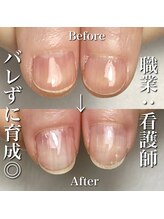 リリー/形が変わります◎