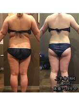 カルム エ コンポーゼ(Calme et Compose')/痩身セルゼロ／上半身12回