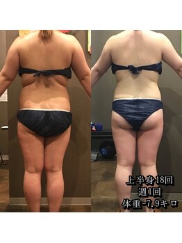 カルム エ コンポーゼ(Calme et Compose')/痩身セルゼロ/上半身12回