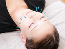 ネイビー鍼灸指圧治療院(NAVY鍼灸指圧治療院)/美容鍼施術承っております！