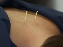 鍼灸院はりセラ 淡路町院