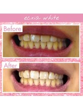 エクシアホワイト 倉吉店(ecxia white)/ビフォーアフター