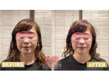 【小顔/リフトアップ/姿勢/骨盤矯正/頭蓋骨/痩身】ヴィオーデ美容整体サロン那覇店/小顔、リンパ、ヘッドスパ、骨盤