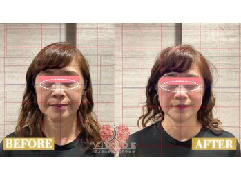 【小顔/リフトアップ/姿勢/骨盤矯正/頭蓋骨/痩身】ヴィオーデ美容整体サロン那覇店/小顔、リンパ、ヘッドスパ、骨盤