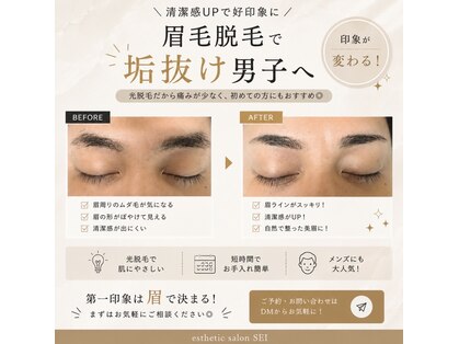 エステサロンセイ(SEI)の写真
