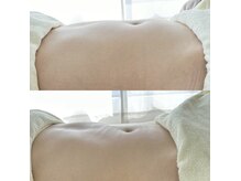 ネムトハ(NEMUTOHA)の雰囲気(疲れやストレスで硬く張ったお腹はオイルケアでスッキリ)