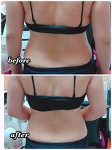 ヨサパーク ナッツベリー なんば桜川店(YOSA PARK Knotts Berry)/結果重視！驚きの痩身効果！