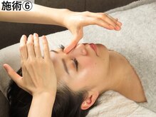 ラプリ 横浜店(Raplit)/施術6 鼻の矯正 鼻筋/曲がり矯正