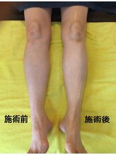 天満みぞぶち整骨院/フットマッサージ