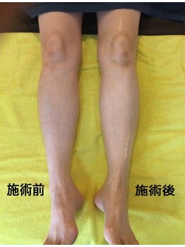 天満みぞぶち整骨院/フットマッサージ