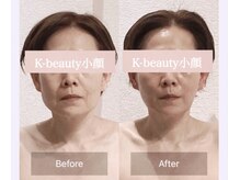 ケービューティー 小顔(K-beauty)の雰囲気（オールハンドで小顔へと導きます）