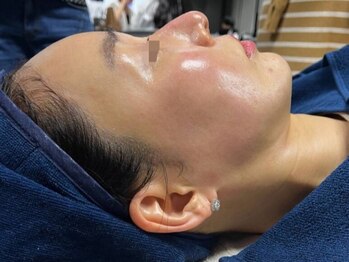 フレアージュ(FLAIRGE)の写真/【スーパージェクション水光肌ケア】韓国発祥で世界に広がっている高評価のエステ最先端コース導入！！
