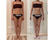 エイプリル/【痩身】比較写真