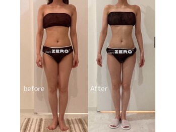 エイプリル/【痩身】比較写真