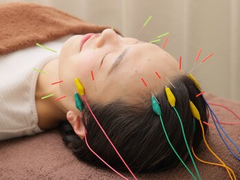 はりきゅう整骨院 健志/電気を流すハリでリフトアップ