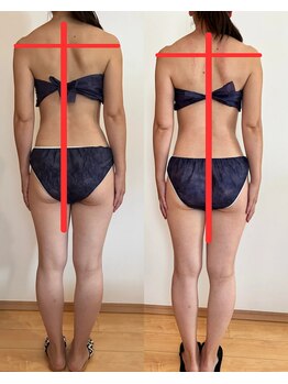 アイナ(Aina)/肩こり＆美姿勢