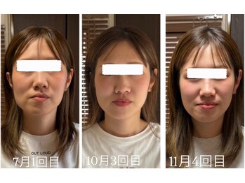 ボーンズ(BONES)/