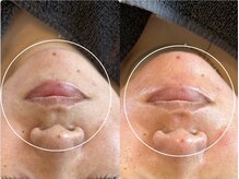 アンベリール(Embellir)/松ヤニワックス♪