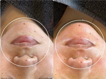 アンベリール(Embellir)/松ヤニワックス♪