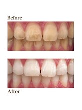 カノン 南熊本店(Kanon)/