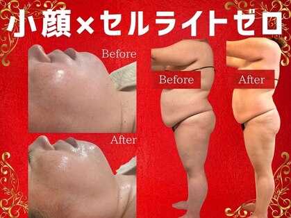 リノア(Lino'aka)の写真