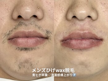 ピブ(pib.)/若く見える効果あり！