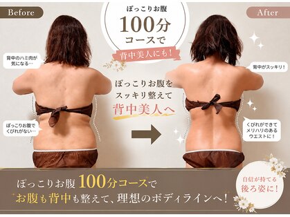 ラディアボディ四十瀬の写真