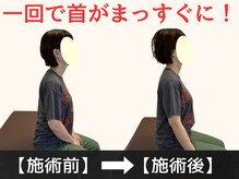 パルマ なかもず(Palma)/整体/頭痛/肩こり/ヘッドスパ