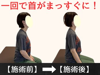 パルマ なかもず(Palma)/整体/頭痛/肩こり/ヘッドスパ