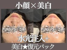 マヴィ 藤井寺店(MavY.)/サブスク人気MENU
