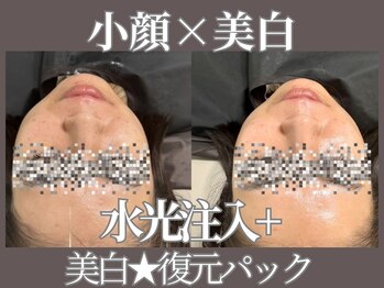 マヴィ 藤井寺店(MavY.)/サブスク人気MENU