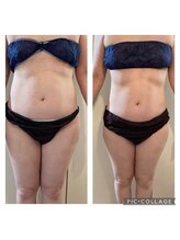 ミニョン(mignonn.)/