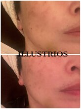 スイートルーム(Sweet Room)/クリスティーナのイラストリアス