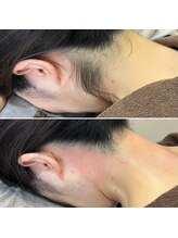 シャンティ(Shanti)/うなじ美人