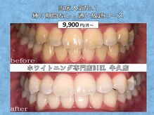 ビエル 牛久店(BIEL)の雰囲気（人気No.1の通い放題プランが縛り期間なしで行えます◎メンズ可♪）