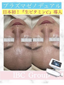 トータルサロンアイビーシー(トータルサロンIBC)/プラズマ+日本初!生ビタミンC