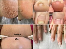 ルクール(Le Coeur)の雰囲気（巻爪、深爪、反り爪、今まで不可能だったかかとなどのお悩みも◎）