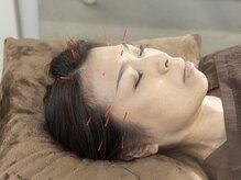 やぎおか堂/鍼灸