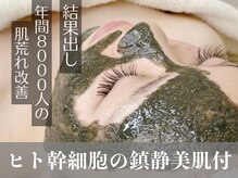 ニキビ研究所 千葉店