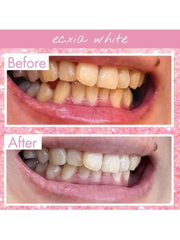 エクシアホワイト 倉吉店(ecxia white)/ビフォーアフター